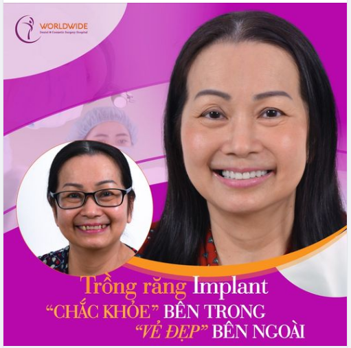 trong rang implant gia re tphcm